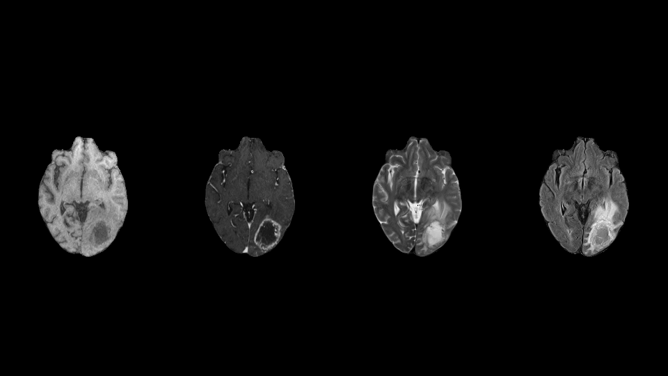 Missing-Data-Robust Medical Imaging Model