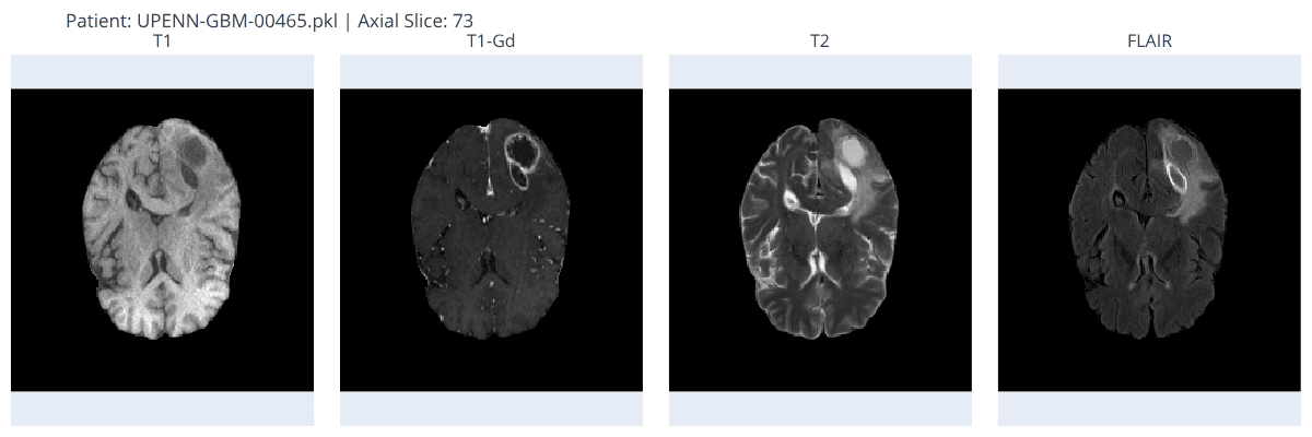https://raw.githubusercontent.com/MiquelGomezCorral/ARA-Medical-MissingData-Robust-Model/main/readme-images/newplot.png