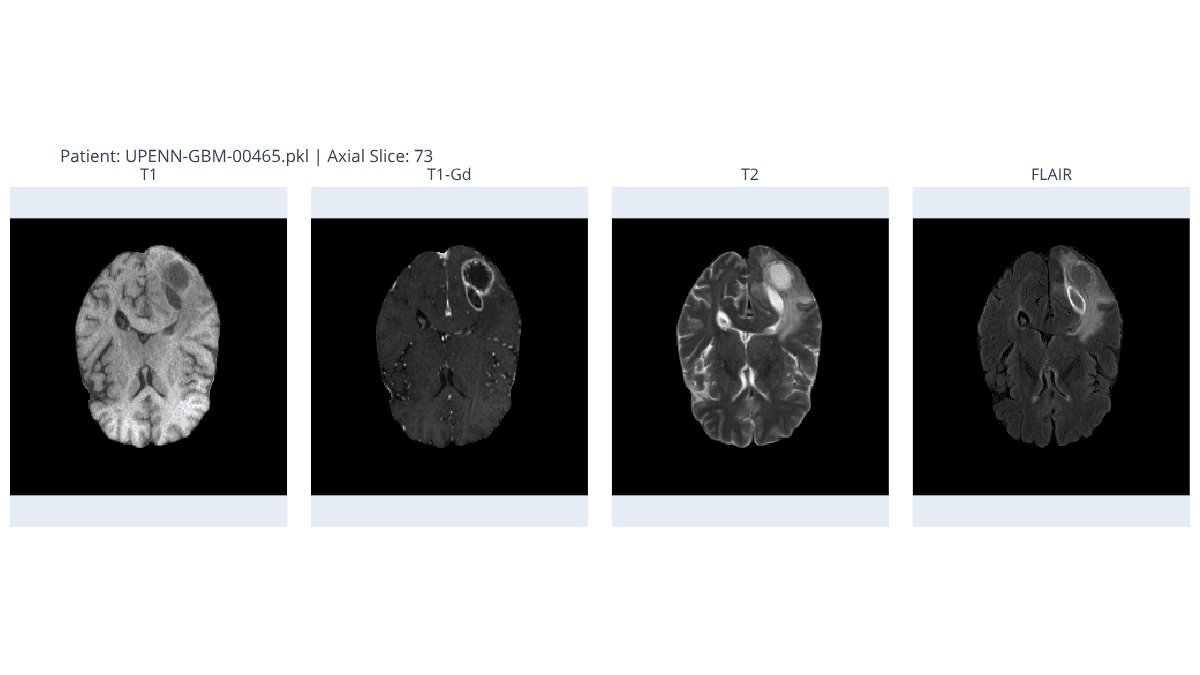 https://raw.githubusercontent.com/MiquelGomezCorral/ARA-Medical-MissingData-Robust-Model/main/readme-images/newplot_169.png